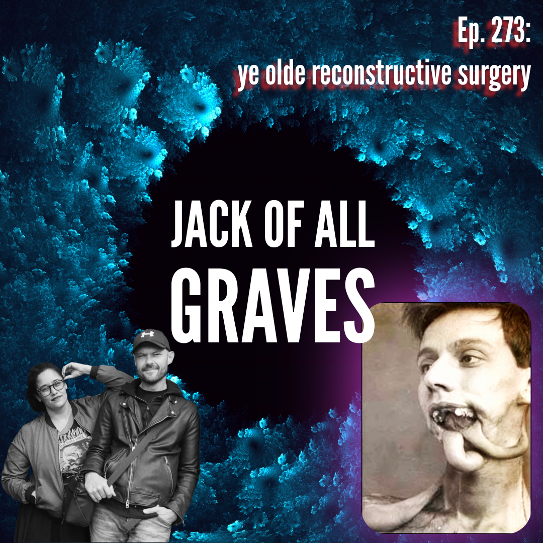 Ep. 273: ye olde reconstructive surgery