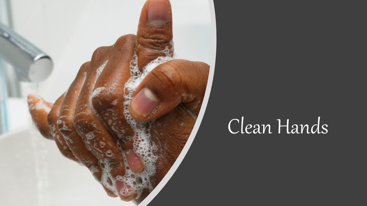 Episode 561: Clean Hands