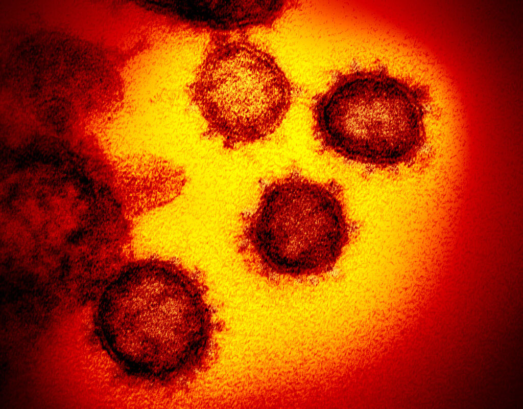 Breakthrough Coronavirus infections 