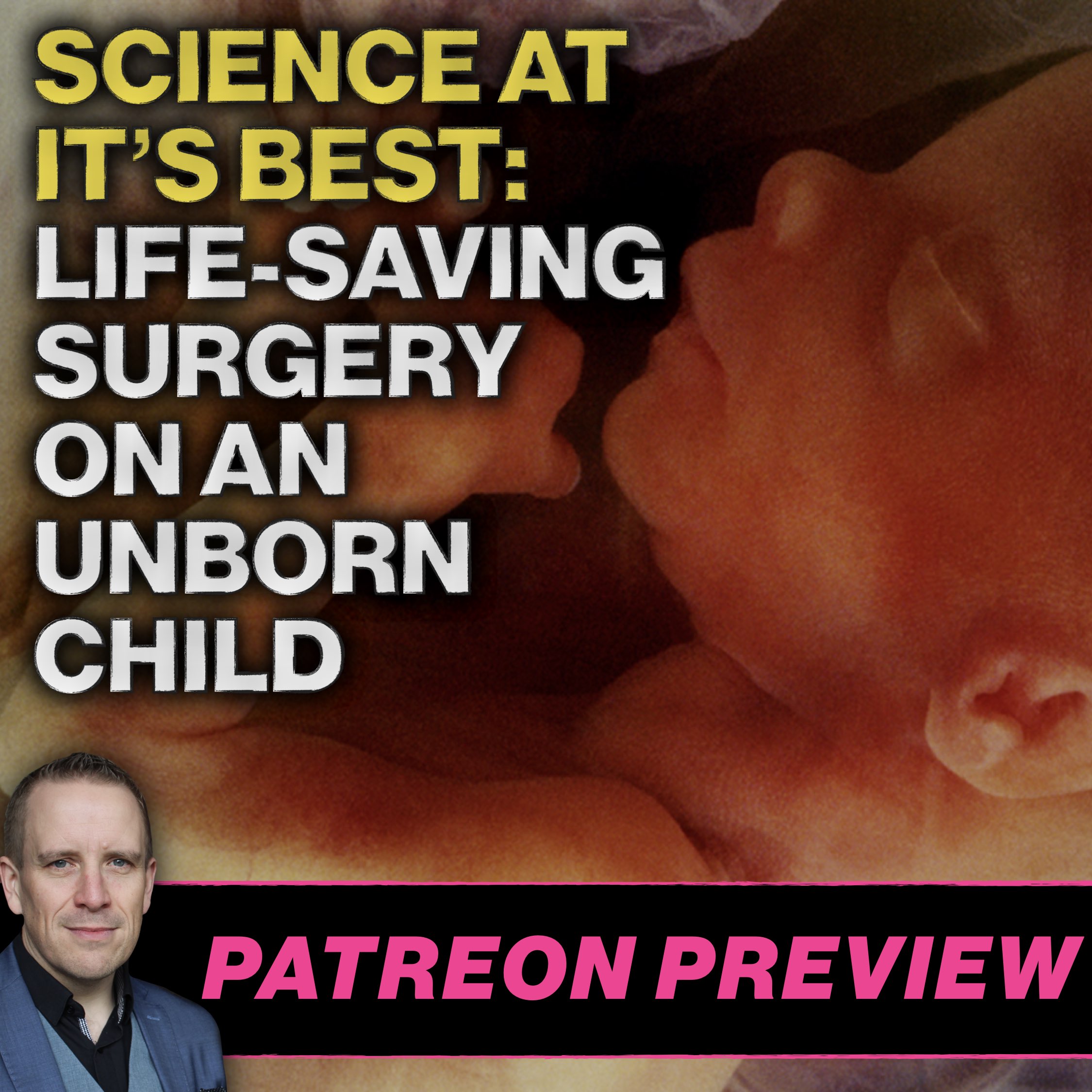 Science at its Best: Life-Saving Brain Surgery on an Unborn Child (Patreon Preview)