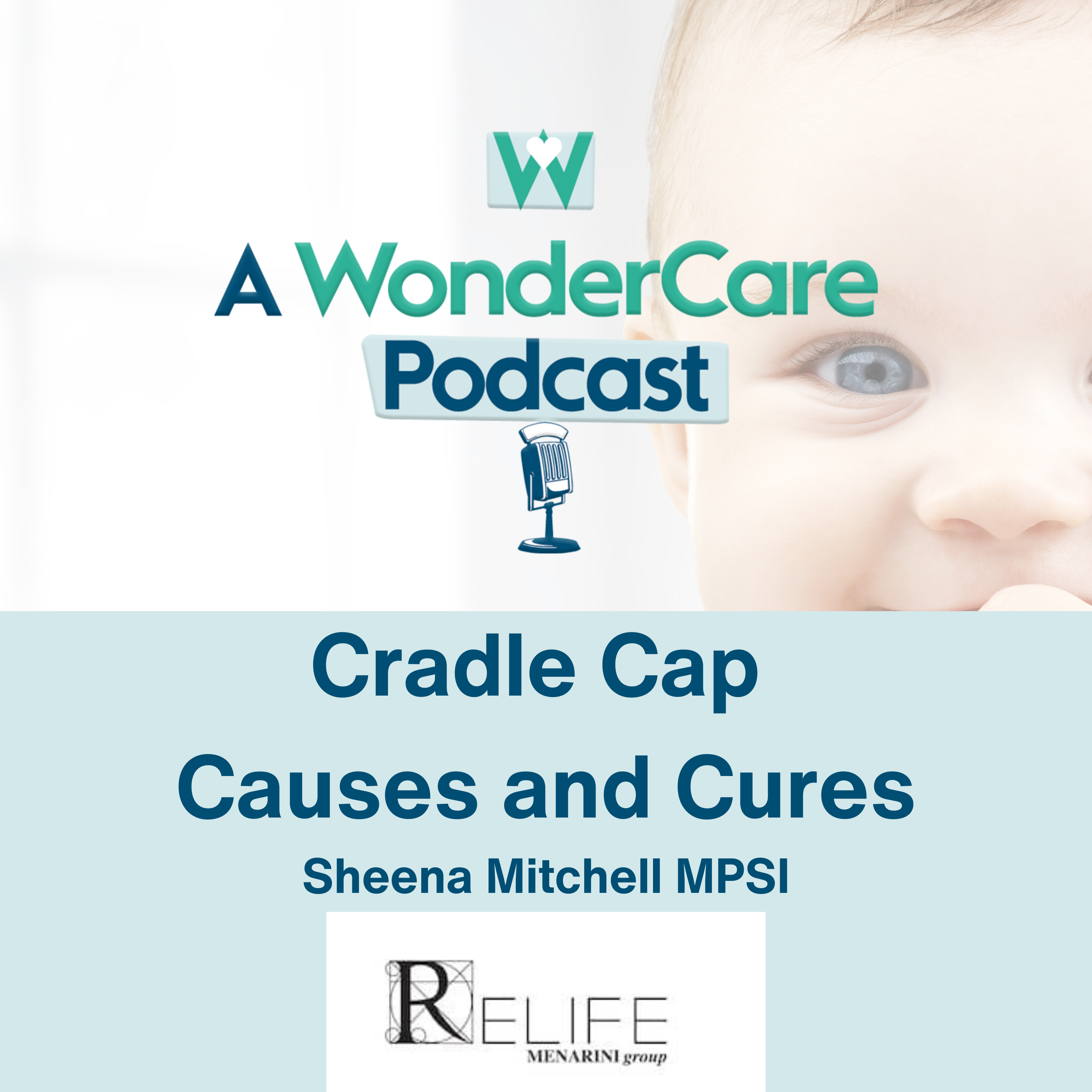 Cradle Cap Causes and Cures!
