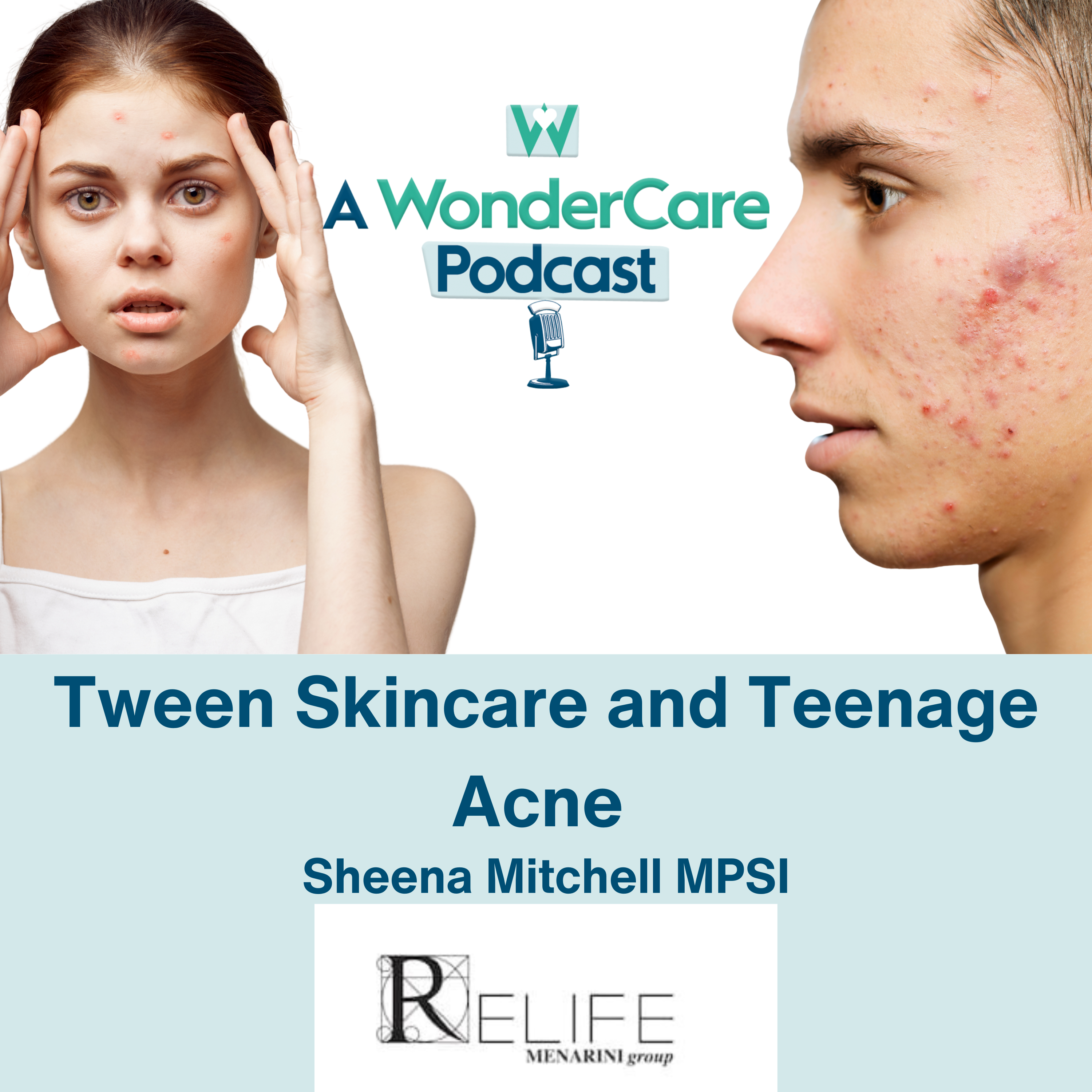 Tween Skincare and Teenage Acne