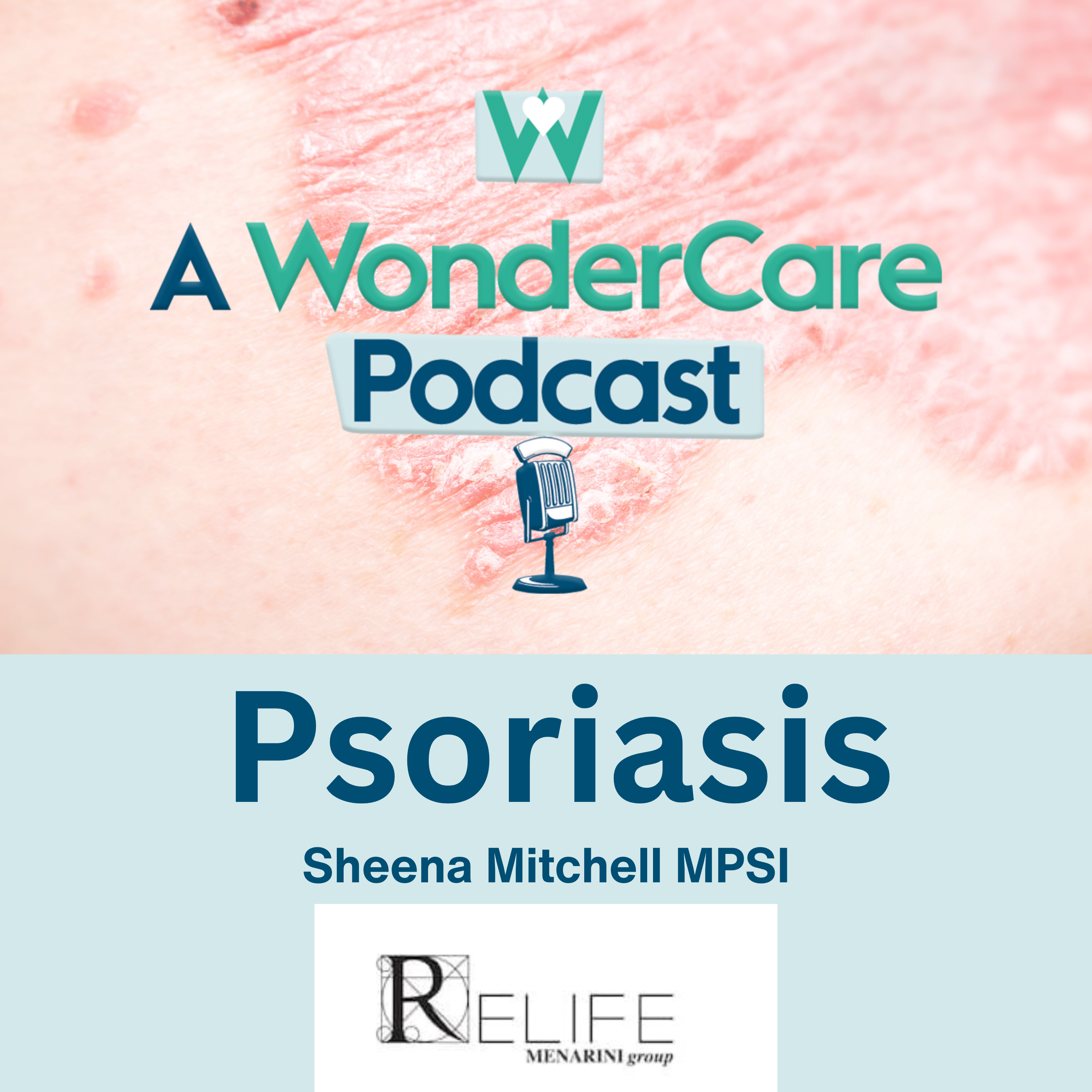 Episode Cover