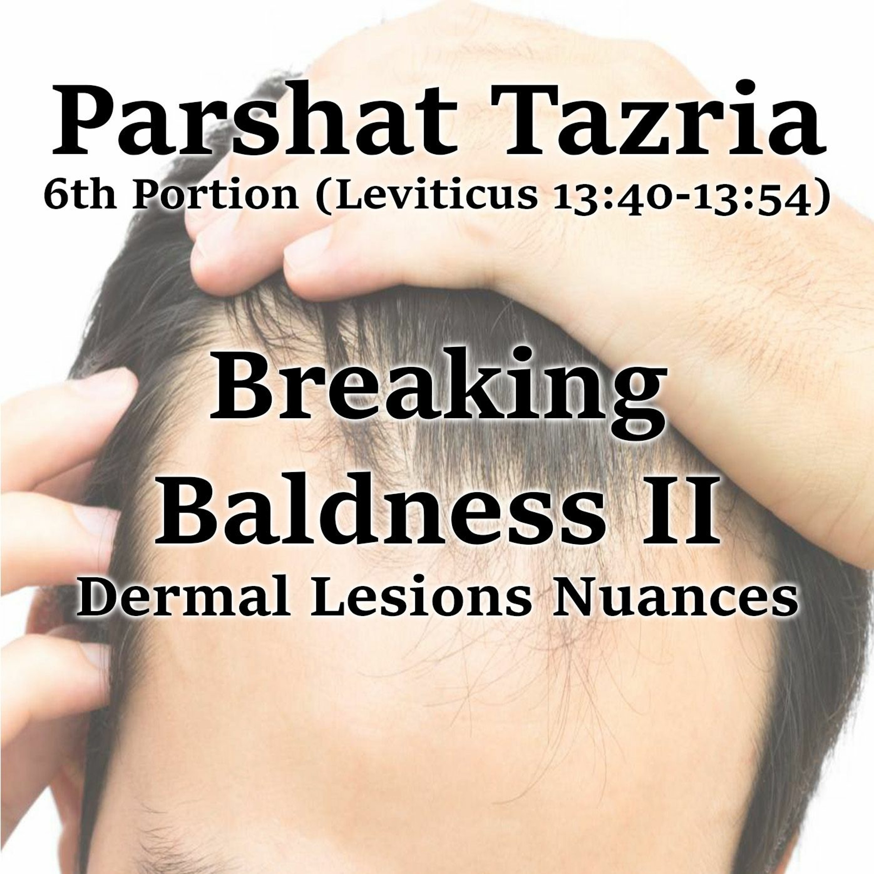 Breaking Baldness II