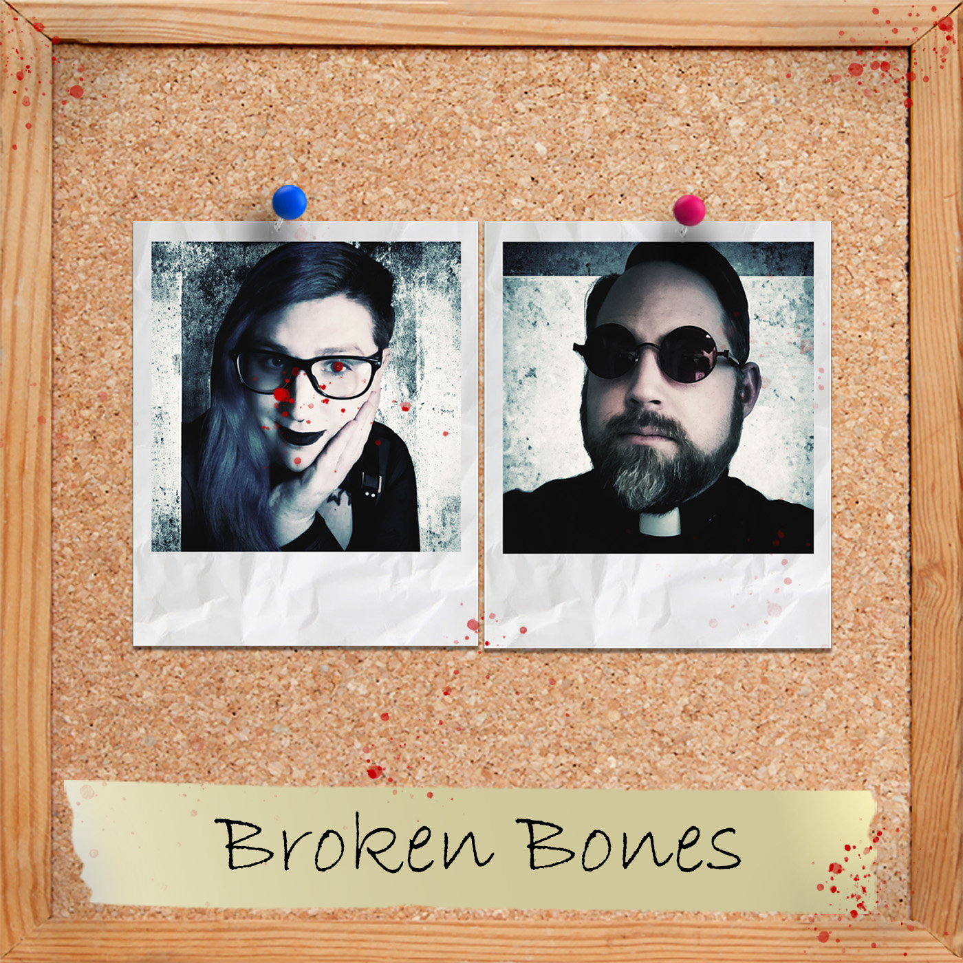 S3 Ep4: Broken Bones