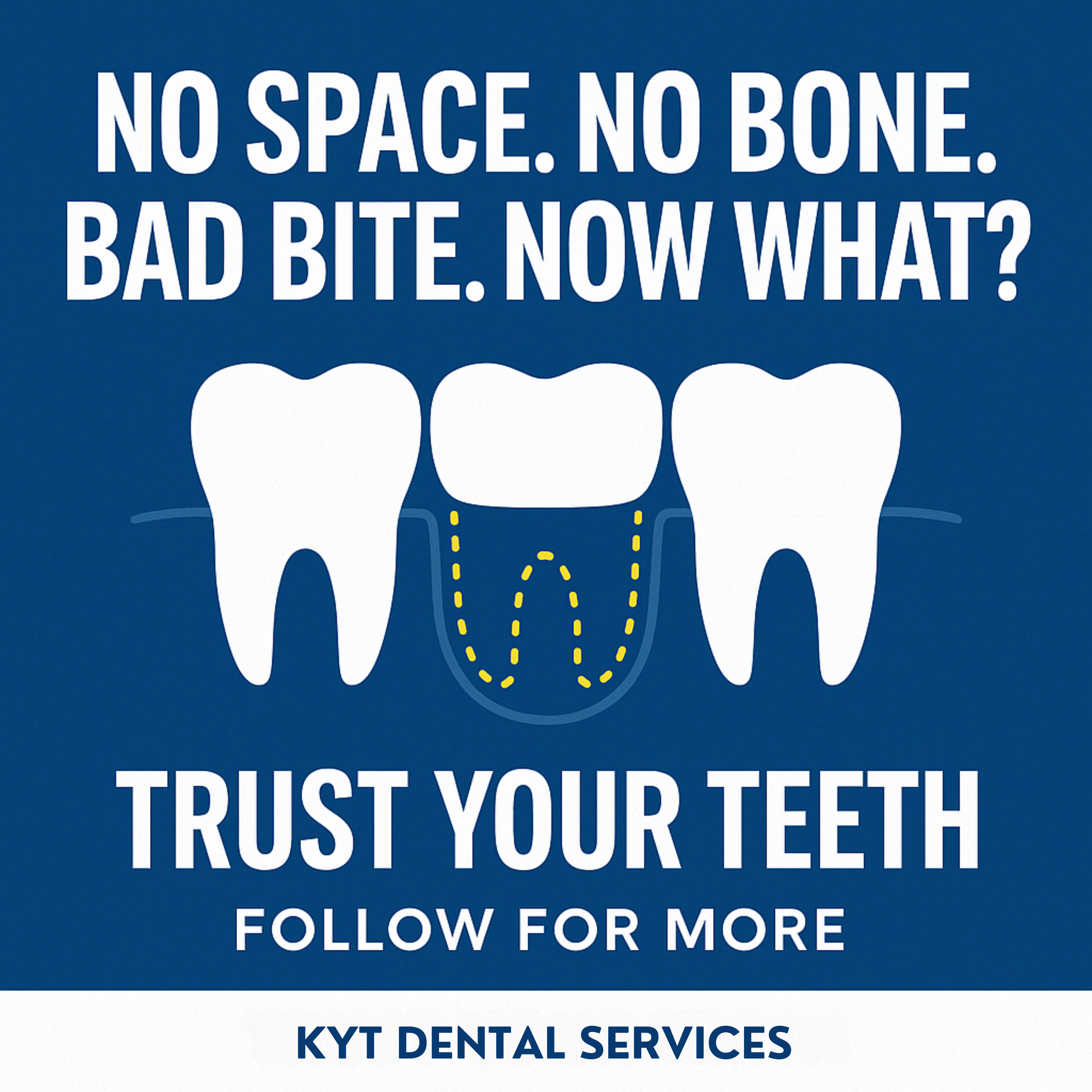 Episode 6: No Space. No Bone. Bad Bite. Now What?