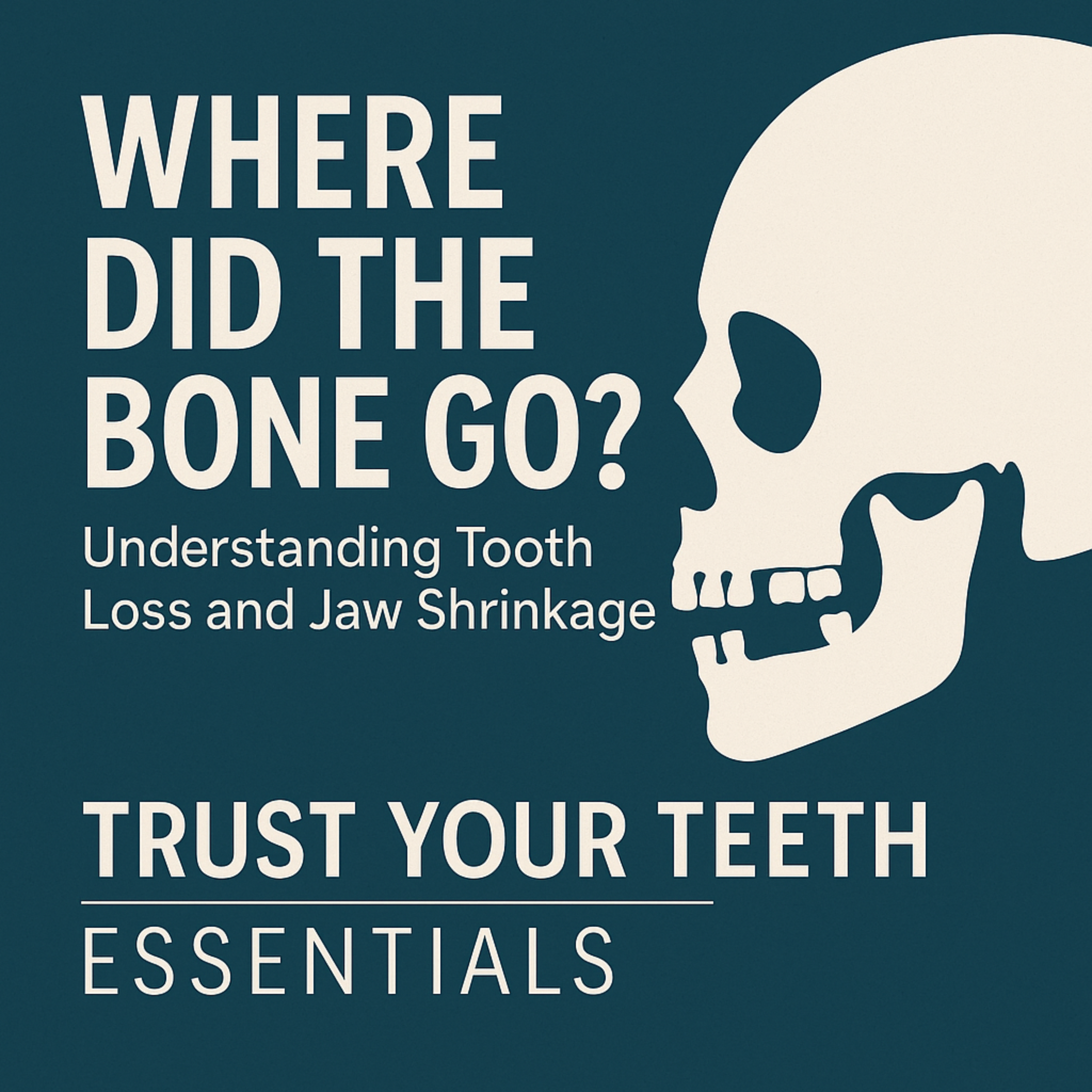 Episode 7: Where Did the Bone Go? Understanding Tooth Loss and Jaw Shrinkage