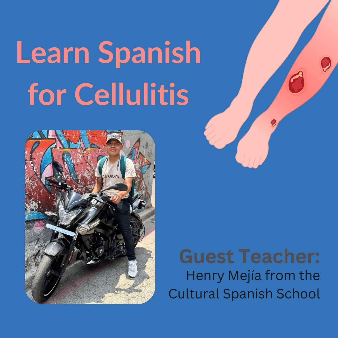 Diagnosis and Treatment of Cellulitis in Spanish
