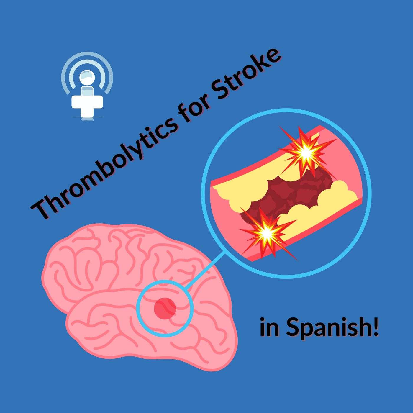 Thrombolytics Contraindications in Spanish – Parte 1
