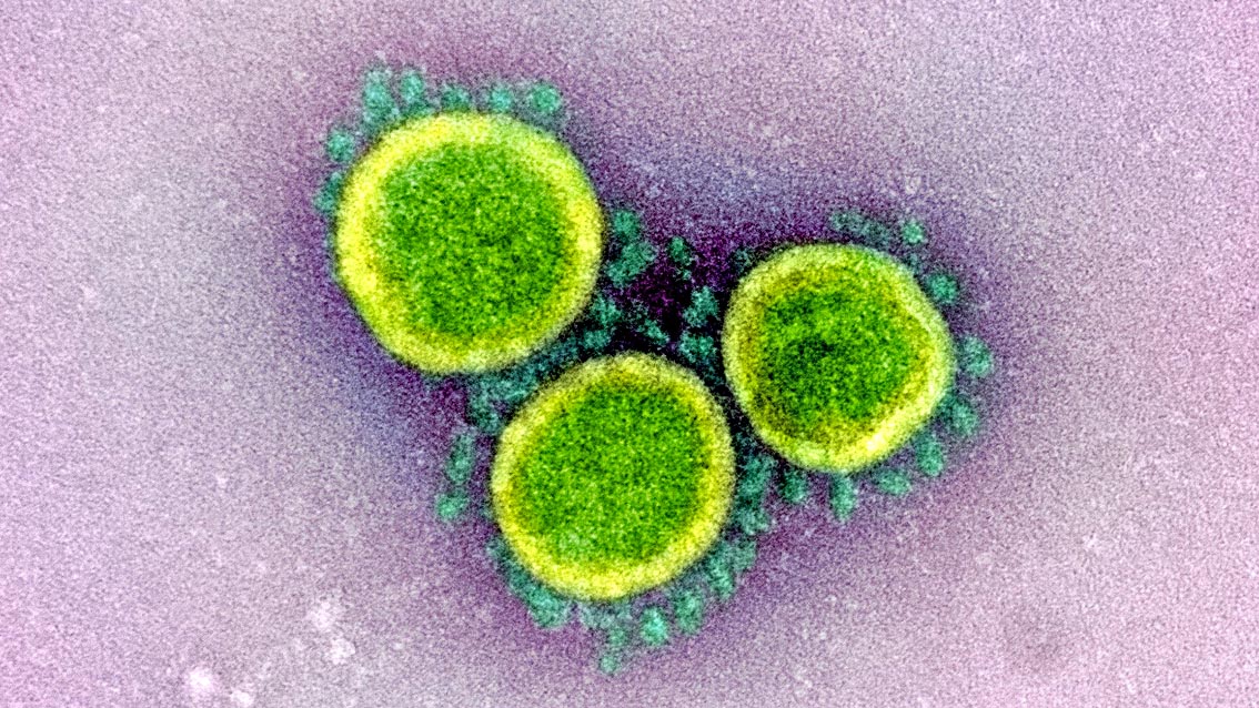 Coronavirus : "Dalla prossima settimana dovrebbero vedersi gli effetti del lock down"